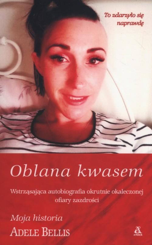 

Oblana kwasem Adele Bellis
