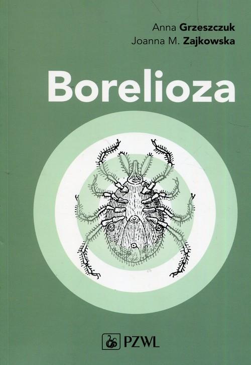 

Borelioza Anna Grzeszczuk, Zajkowska Joanna M.