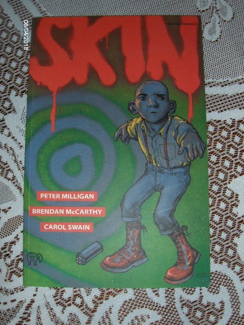 SKIN -PETER MILLIGAN!!!