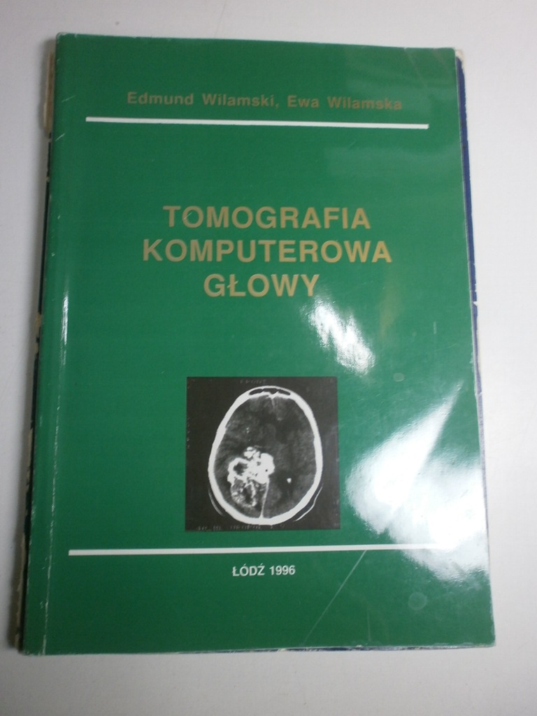 Tomografia komputerowa głowy Wilamski