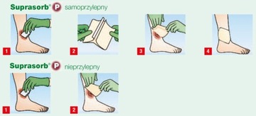 Повязка из пенополиуретана Suprasorb P 10см x 10см