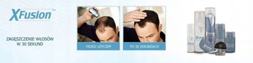 XFUSION 28g Mikrowłókna do Zagęszczania Włosów Oryginalny USA