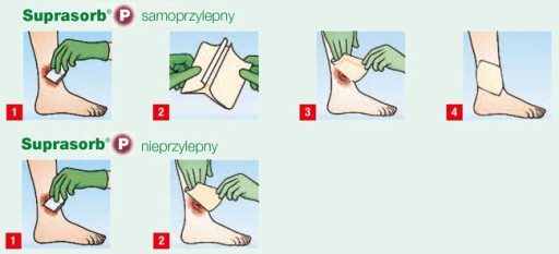 Повязка из пенополиуретана Suprasorb P 10см x 10см